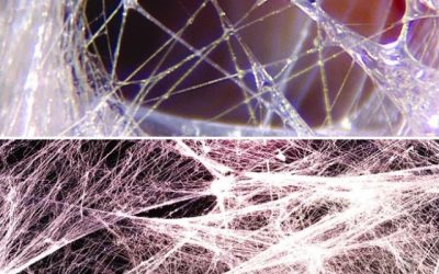 Fascia: The Hidden Web of Healing Inside You